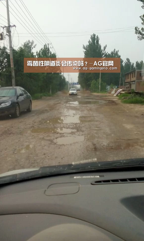 霉菌性阴道炎会传染吗？-AG官网